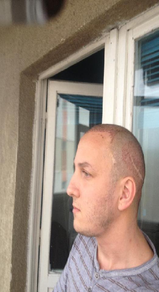 In urma primei interventii, Mihai s-a ales cu grave cicatrici