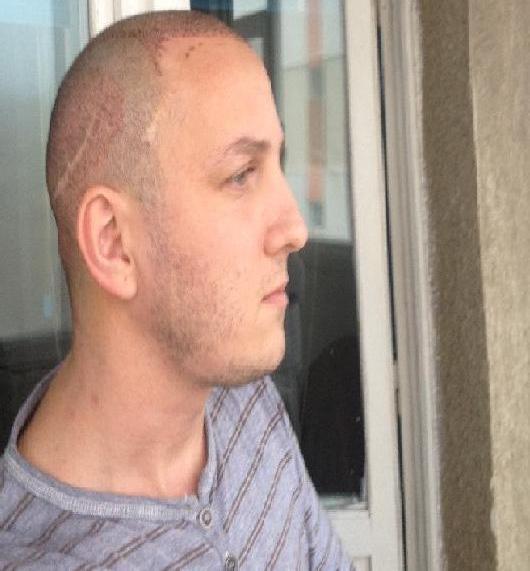 Din pacate, Mihai nu mai poate sa-si ascunda prea bine ciatricile