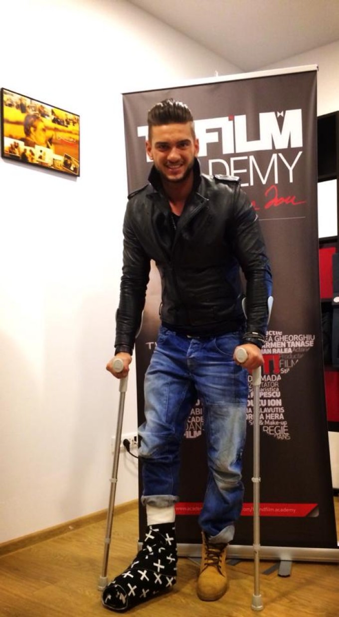Dorian Popa si-a rupt piciorul la snow-boarding, iar acum trebuie sa poarte gips