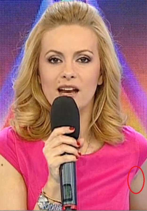 Simona a aparut intr-o rochie fara maneci, care lasa sa se vada vanataia