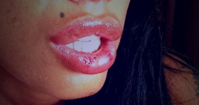 Si-a dorit sa aiba buzele cat Bianca