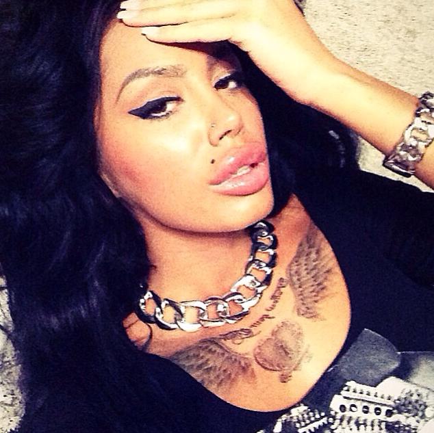 Bruneta si-a injectat atat de mult acid hialuronic ca nu mai poate inchide gura