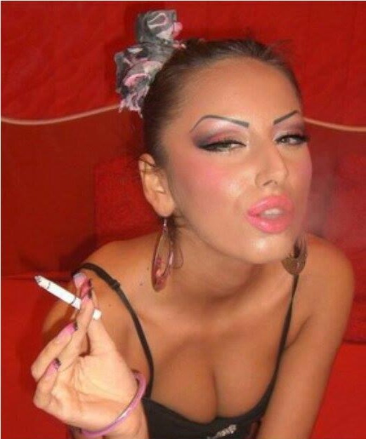 Alina a facut cel putin cinci interventii chirugicale