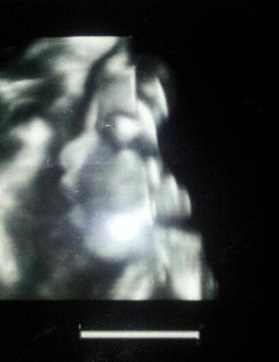 Anna a facut publica prima ecografie 4D cu bebelusul ei