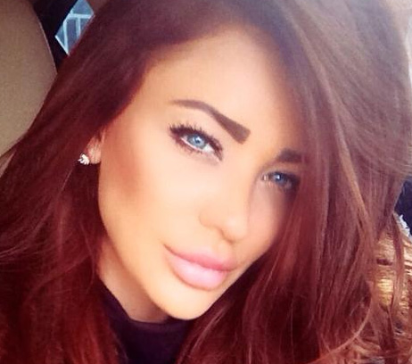 Roscata si-a dat seama ca a exagerat cu acidul hialuronic pe care si l-e injectat in buze