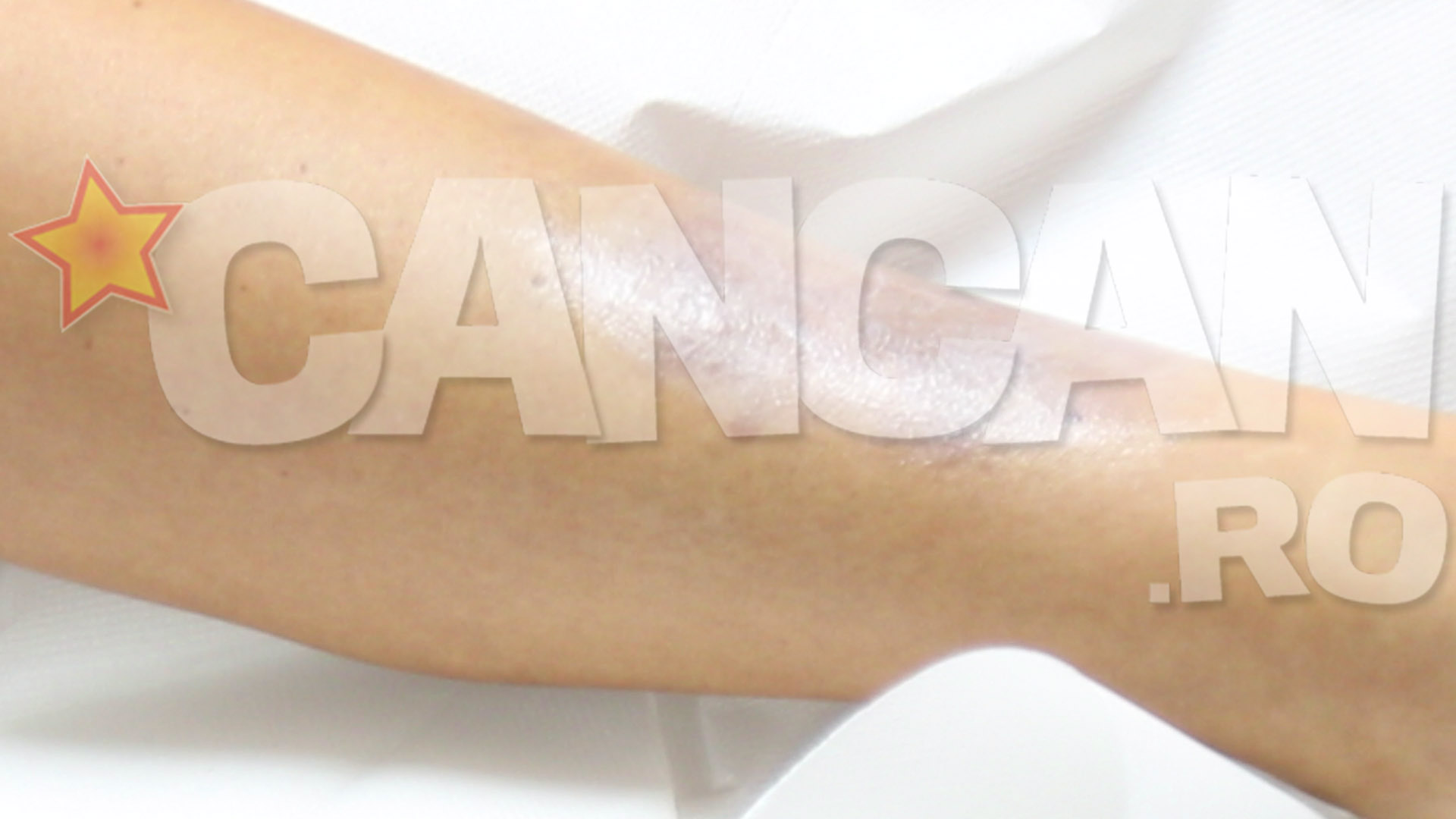 Bianca e nevoita sa isi acopere vanataile cu machiaj