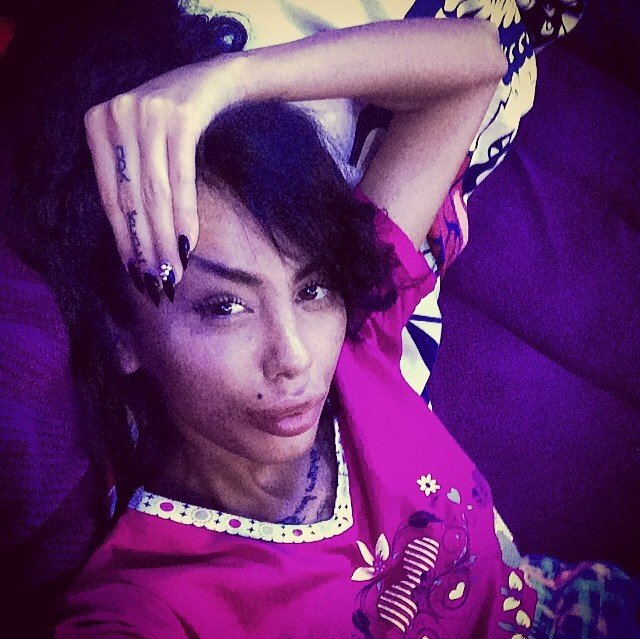 Alina este obsedata sa aiba buzele cat mai mari