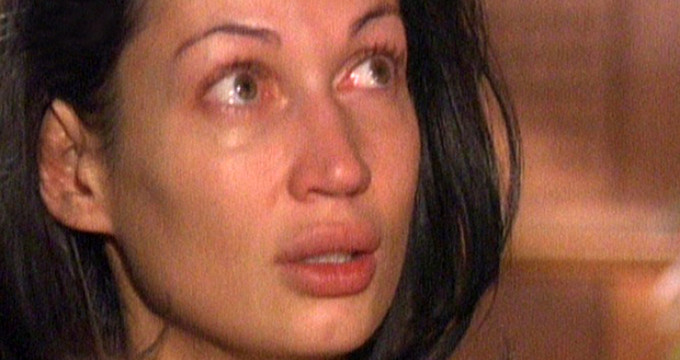 Luciu a trecut printr-un calvar din cauza problemelor cu tenul