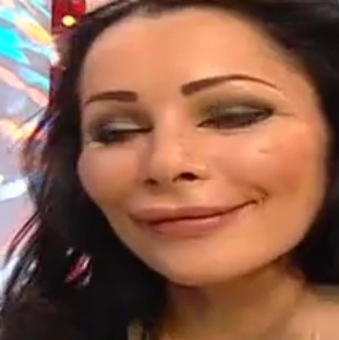 Medicii i-au spus ca fata ei va ajunge la forma dorita abia dupa 6 luni de la operatie