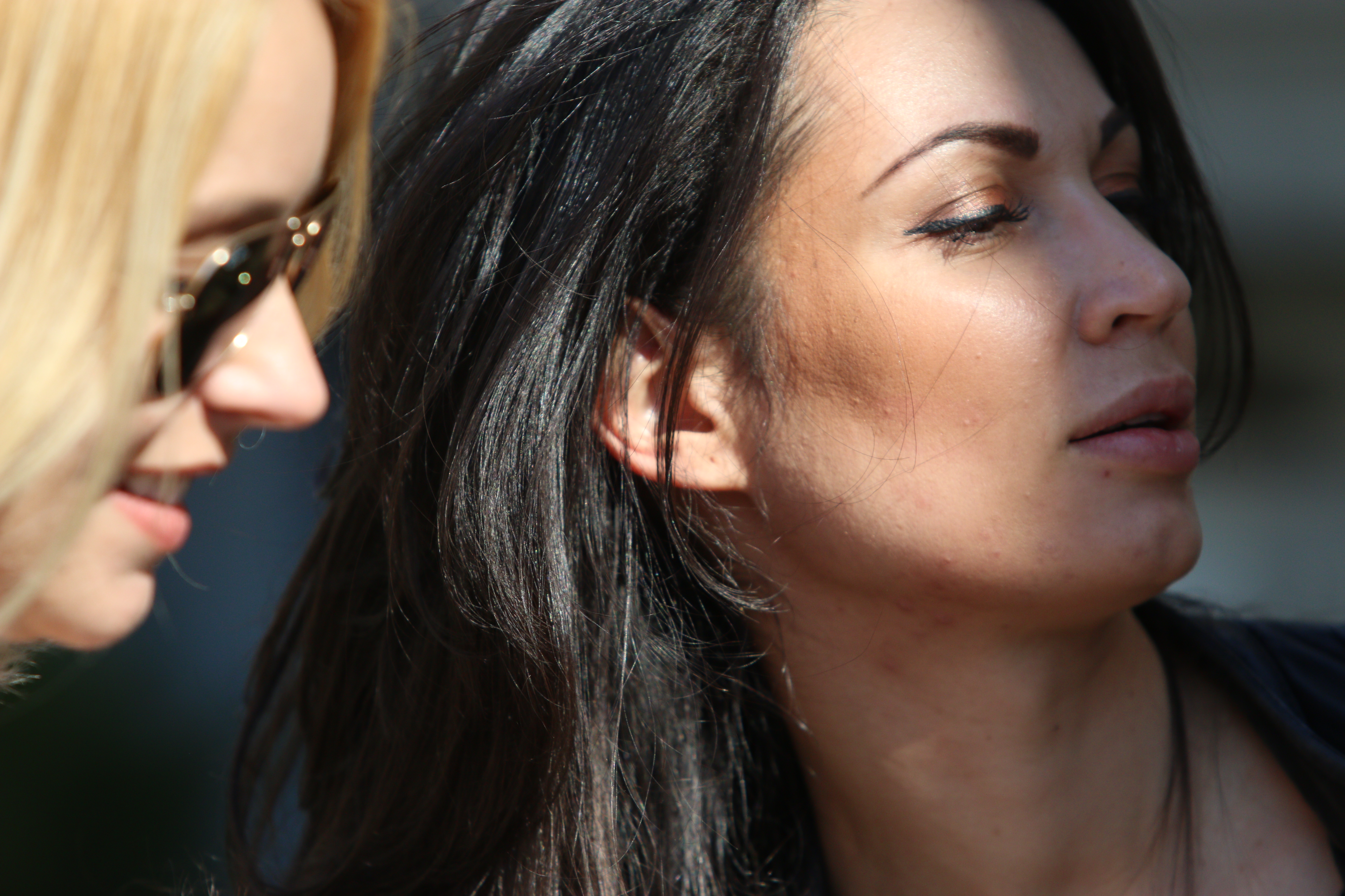 Nicoleta inca mai are bube pe fata, chiar si la doua luni dupa inceperea tratametului