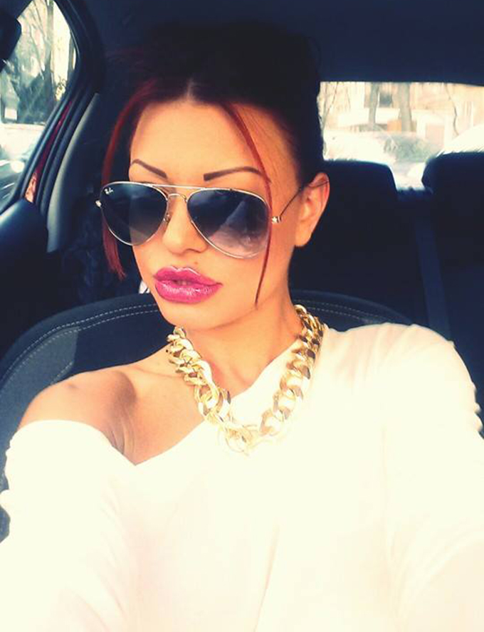 Luni, Ana Maria a fost la o clinca si si-a injectat acid hialuronic in buze