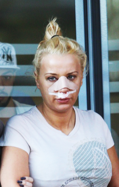 Asa arata Simona dupa cea de-a patra operatie la nas