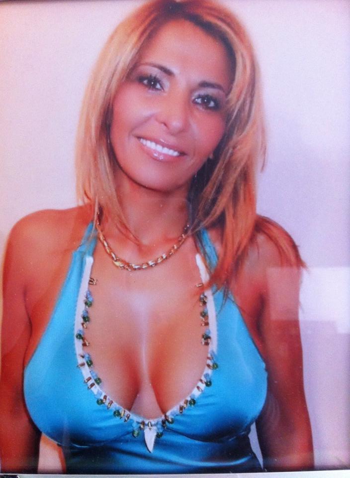 Casnica inainte de operatia de micsorare a sanilor