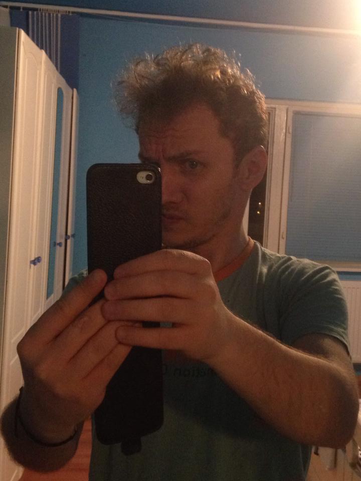 Interventia a avut rezultate spectaculoase, iar parul lui Mihai a inceput sa re regenereze