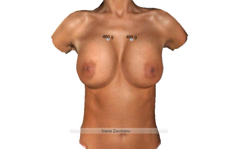 Oana a testat deja cum i-ar sta cu noile silicoane