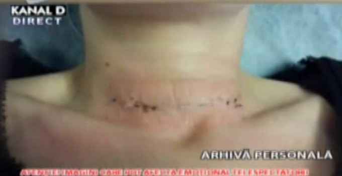 Mariana Rosca s-a operat la gat acum o luna, in Liban