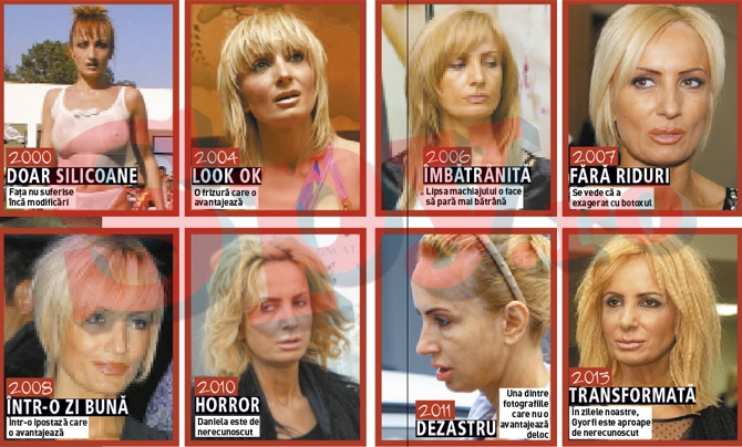 Operatiile prin care a trecut Daniela