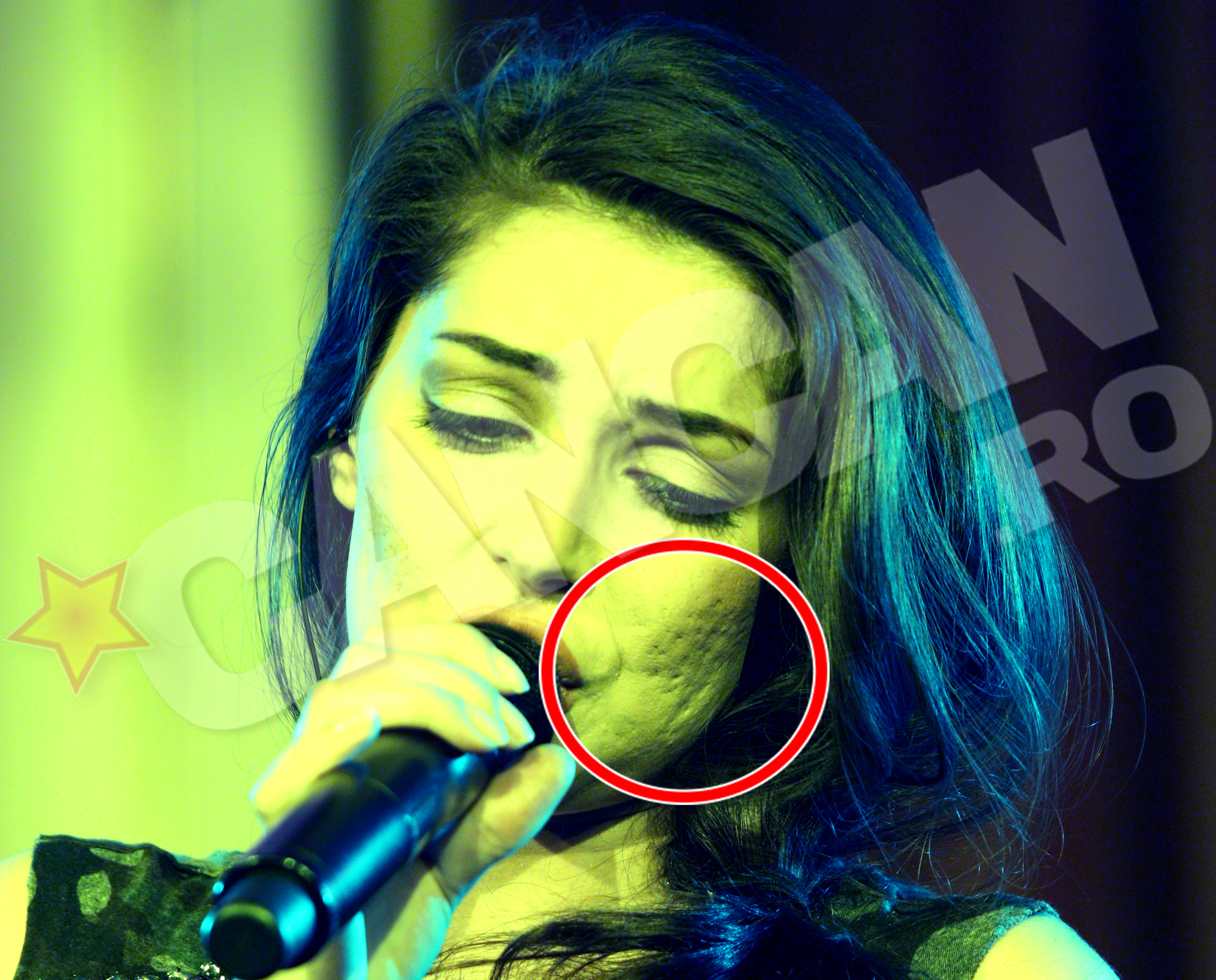 Chiar daca a scapat de cosuri, Elena are in continuare probleme cu tenul