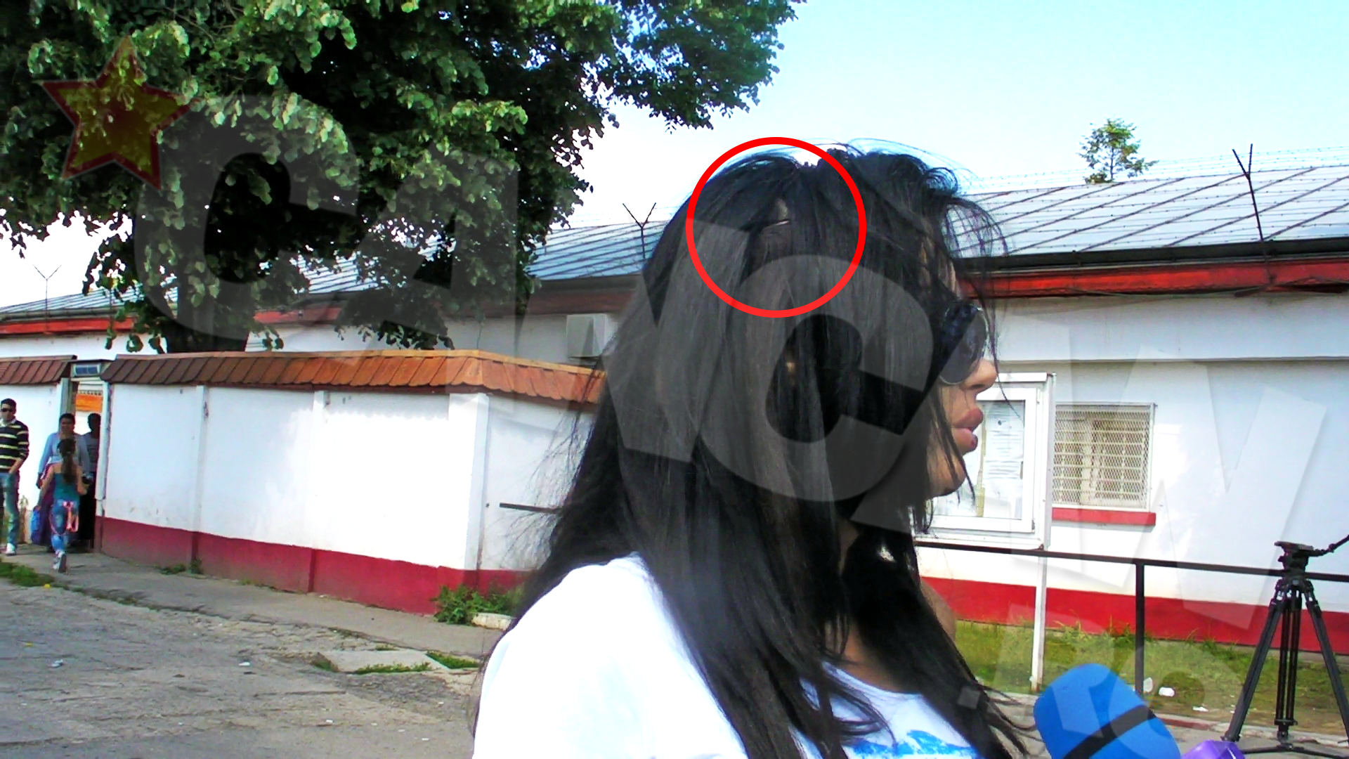 Atunci cand i se ciufuleste parul, va vede cu ochiul liber ca are mese de par