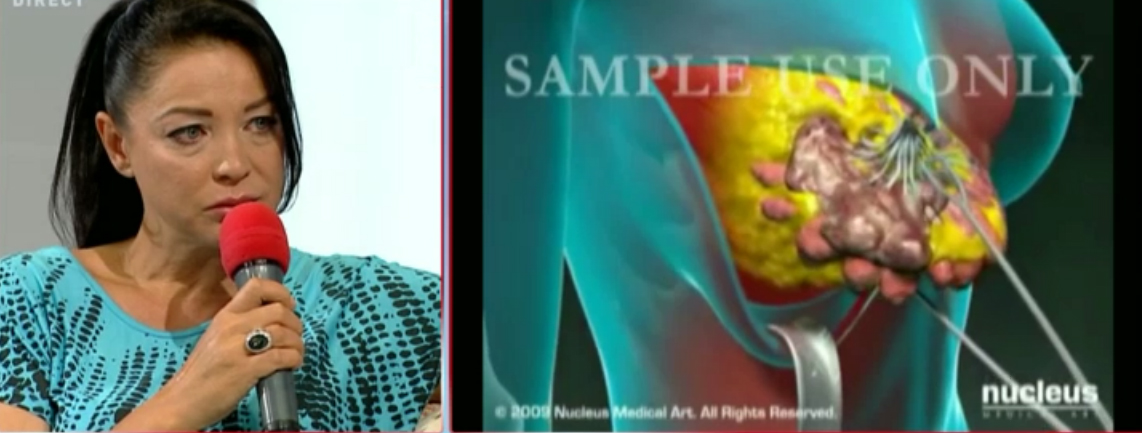 Eugenia a inceput sa planga atunci cand Maruta a explicat publicului in ce va consta operatia ei