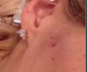 Iubita lui Catalin Cazacu a aratat locul in care campionul la motociclism ar fi muscat-o de fata