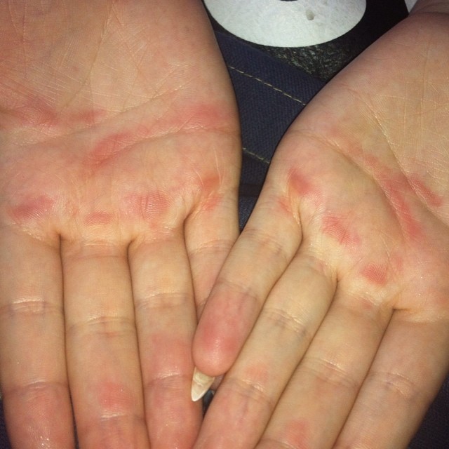 Vedeta se supune unor chinuri groaznice pentru a scapa de kilogramele in plus