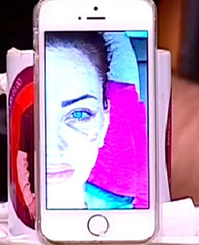 Bianca are chipul plin de vanatai dupa un accident la piscina