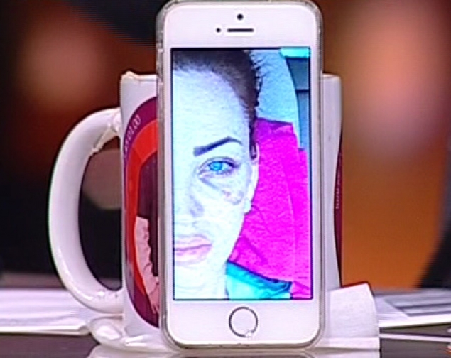 Vedeta a fost desfigurata dupa o saritura in bazin