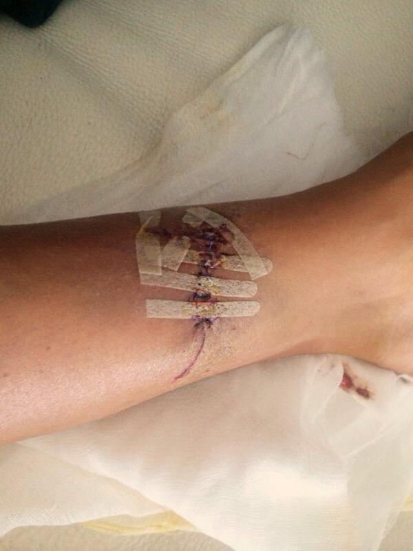 Bianca are durerei ingrozitoare, in urma operatiei