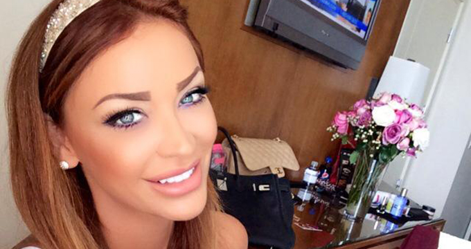 Bianca are acum buzele voluminoase, dar a disparut efectul exagerat