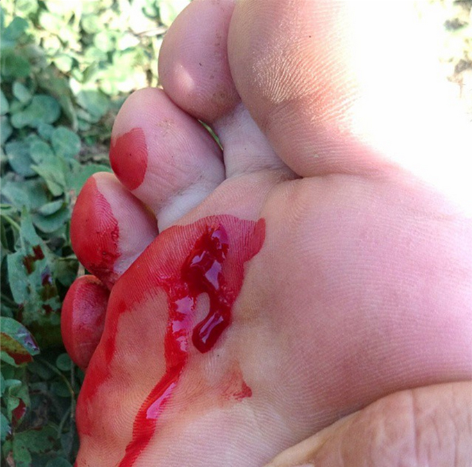 In timp ce trebaluia prin curte, acesta a reusit sa se accidenteze destul de serios