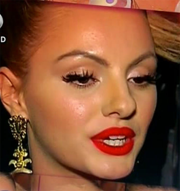 Alexandra Stan s-a umplut de punctulete pe toata fata