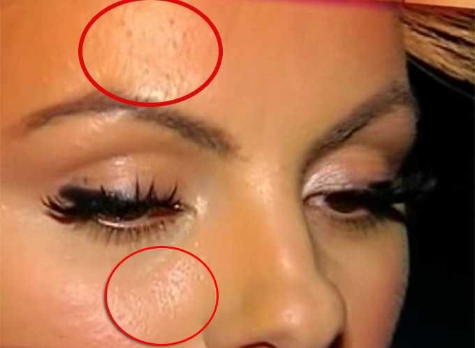 Vedeta are cosuri pe frunte si pometi