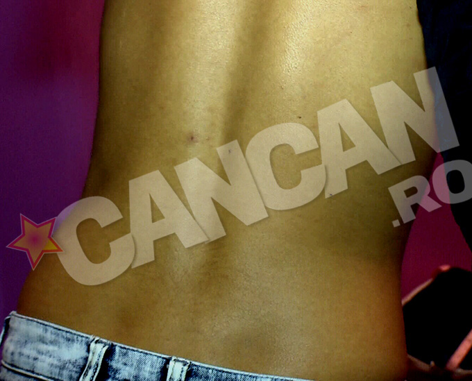 Asa arata spatele Madalinei dupa ce a incercat sa o opreasca pe Narcisa