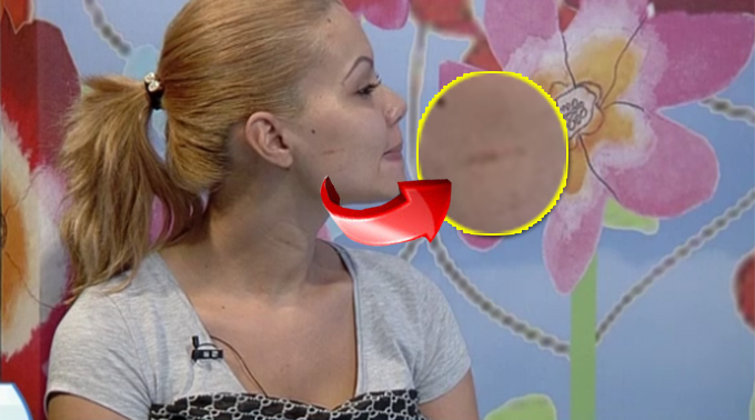 Madalina are taieturi si zgarieturi pe toata fata