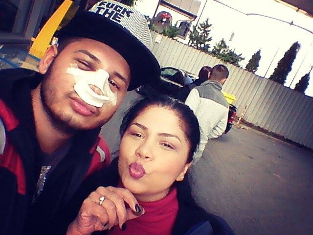 Dupa operatie, Pescariu a iesit in oras