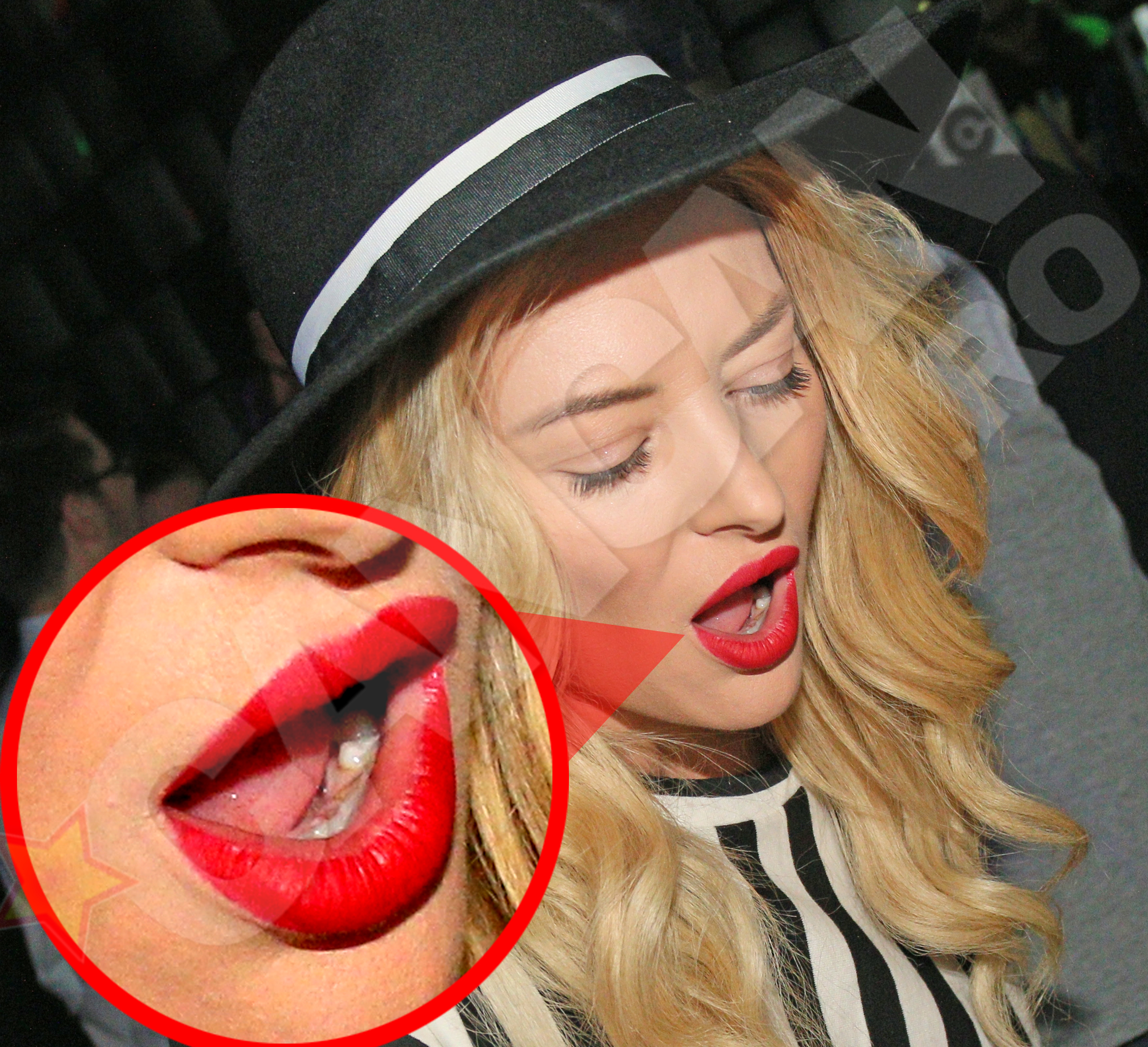 Delia are tartru din cauza fumatului excesiv