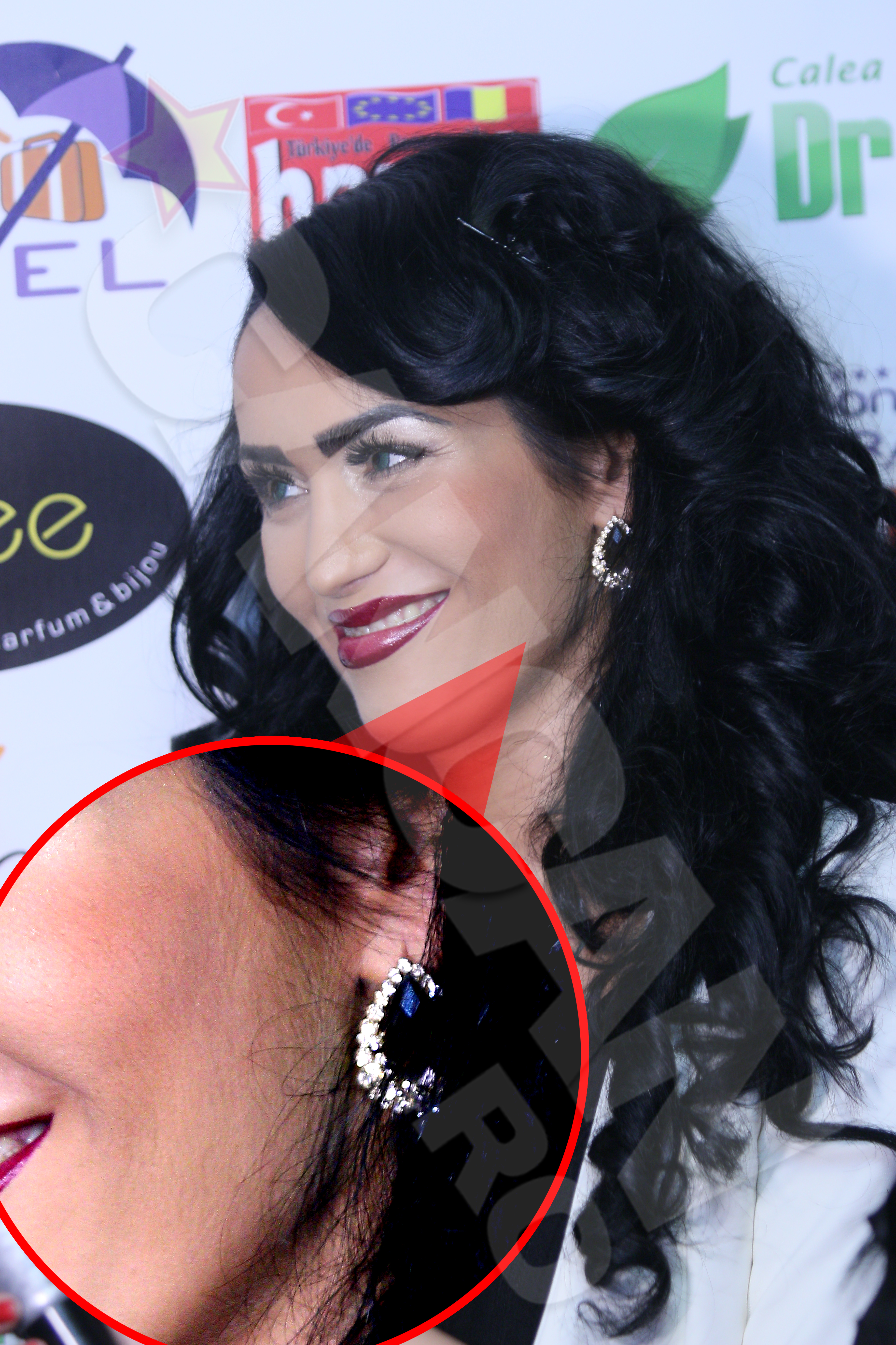 Margherita are o multime de par inestetic pe fata