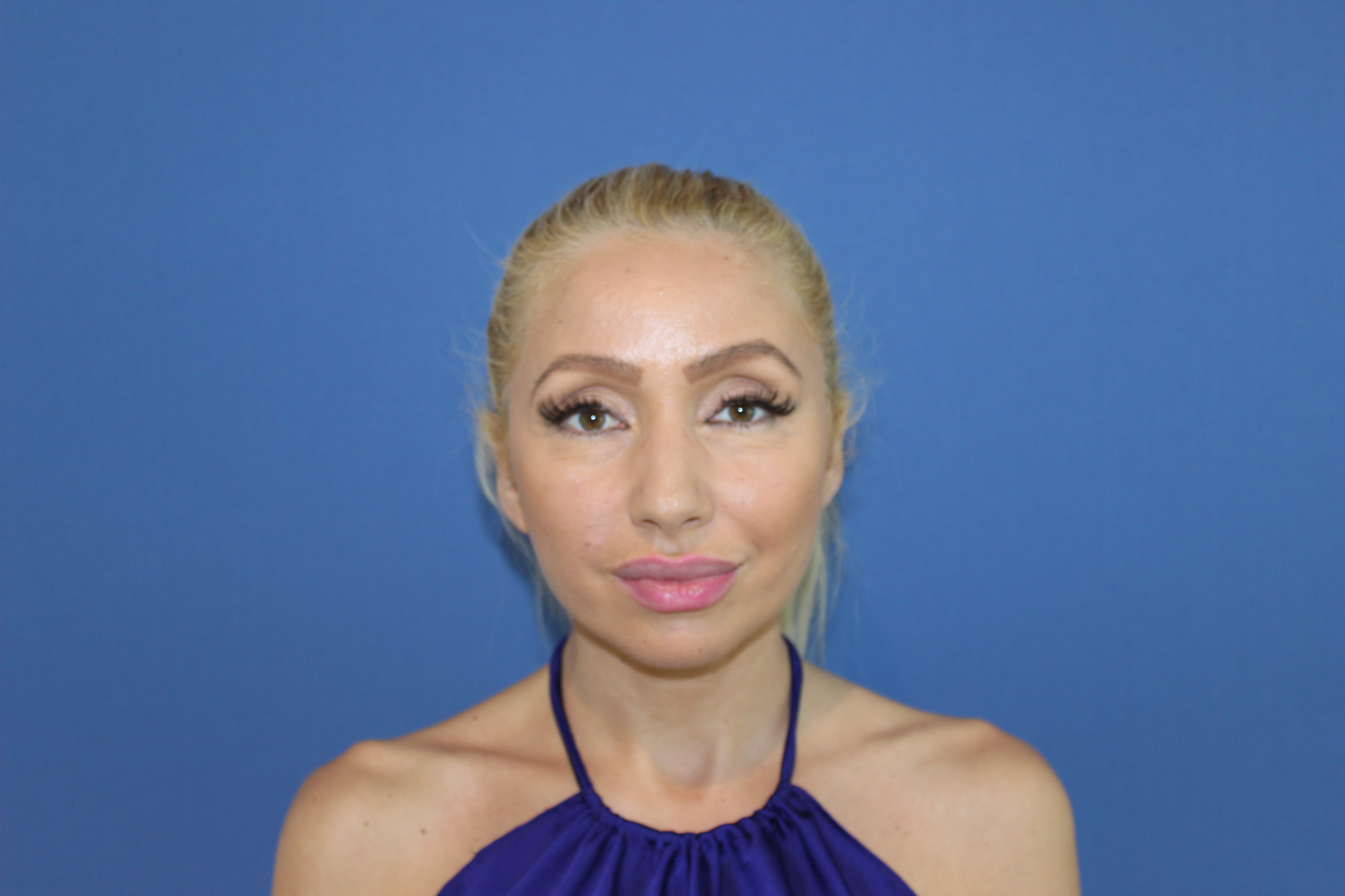 Asa arata Sonia acum, dupa operatie