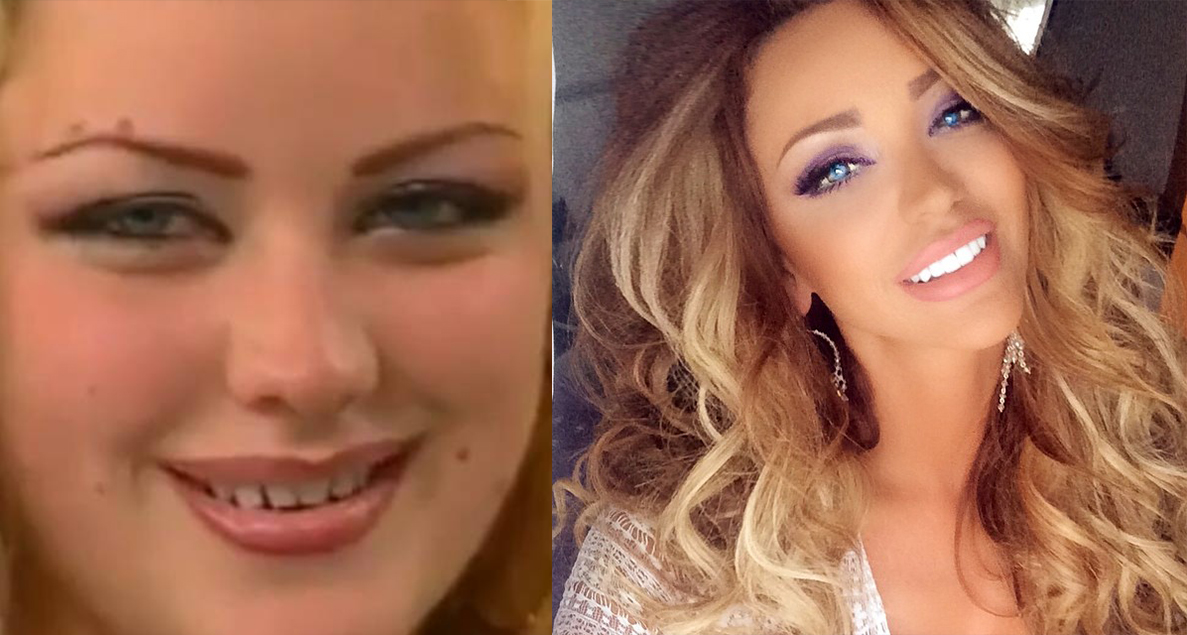 Biabca si-a recunoscut intotdeauna defectele fizice