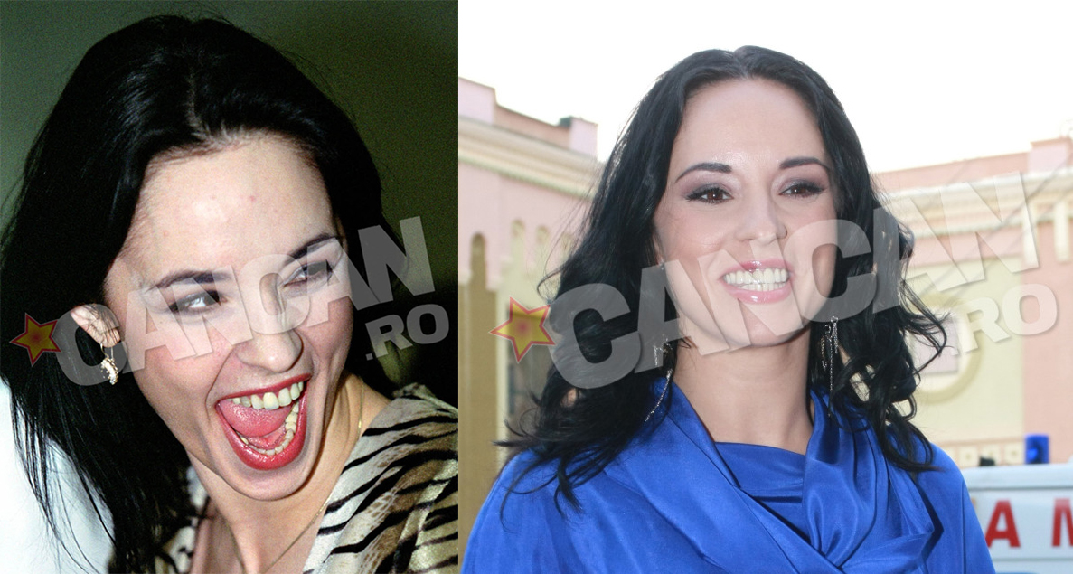 Andreea Marin si-a reparat dantura destul de tarziu, acum cativa ani abia