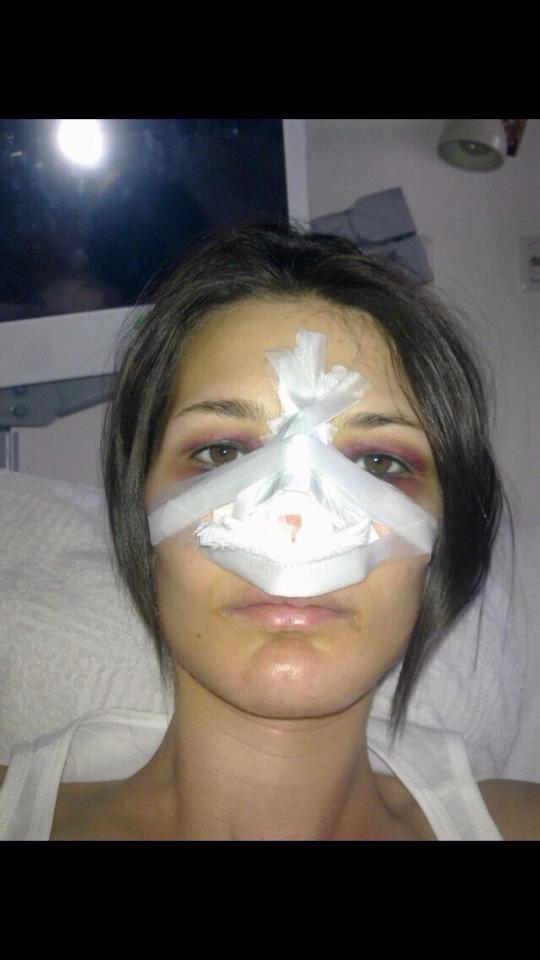 Dovada ca Roxana si-a operat nasul