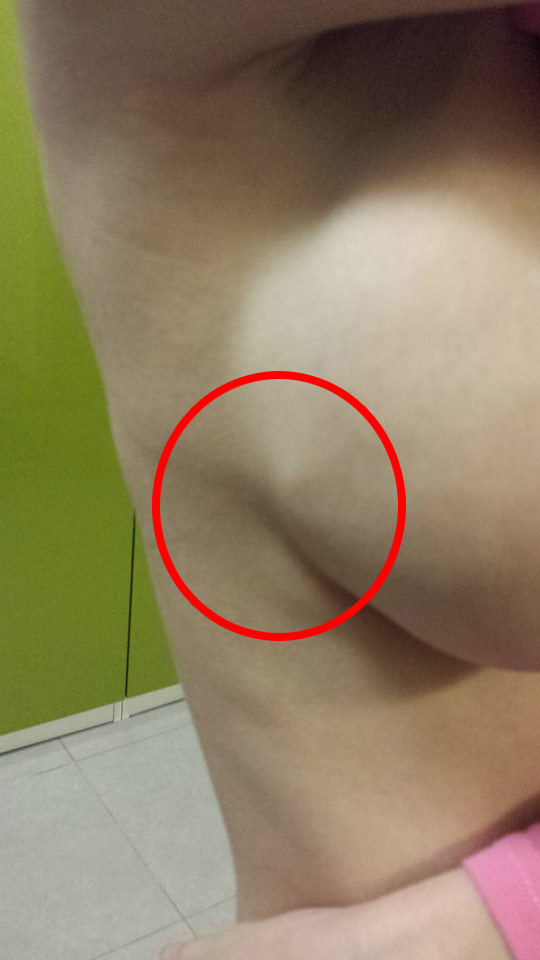 Asa arata acum sanii Florinei Mihaila