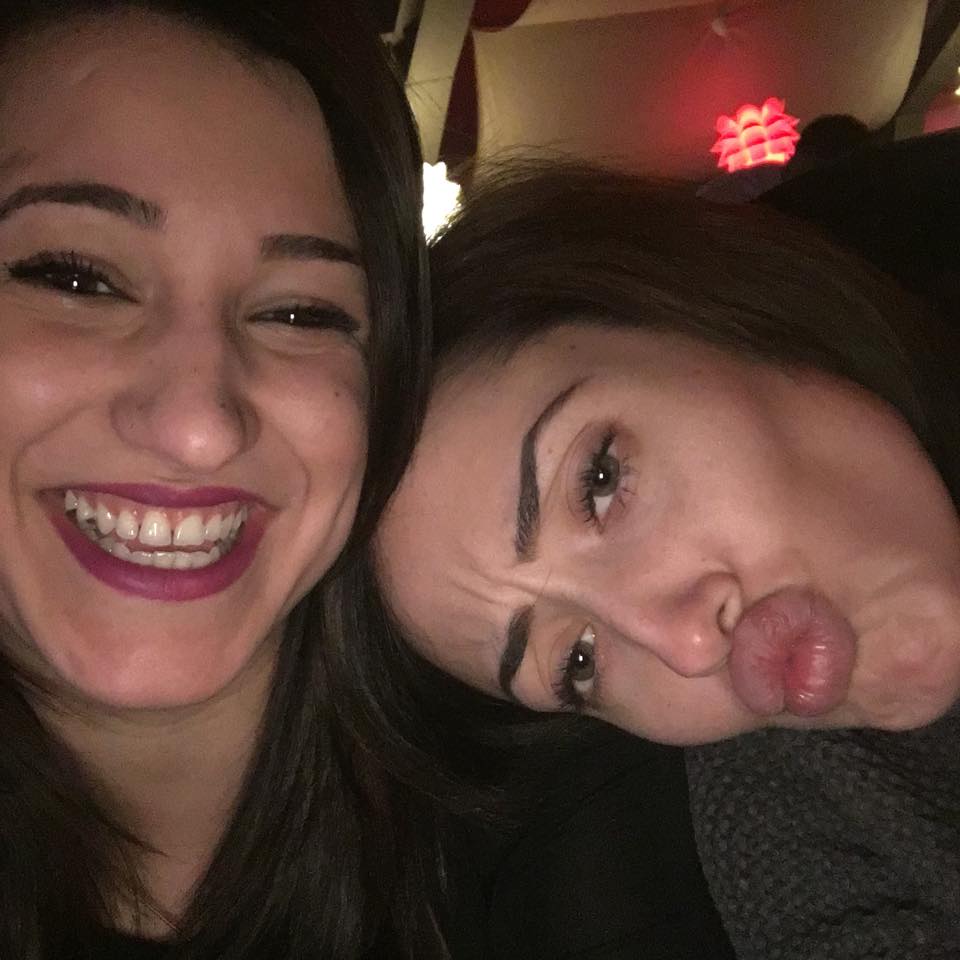 Nidia Moculescu pare ca si-a pus acid hialuronic in buze