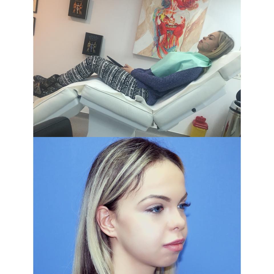 Asa arata Sabrina inainte de interventia estetica