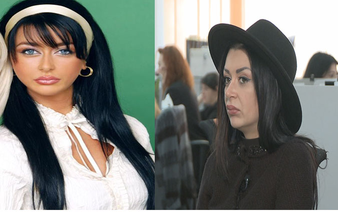 Bruneta are probleme de sanatate din cauza interventiilor chirurgicale