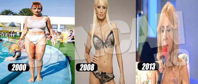 Cantareata este printre primele vedete din Romania care au apelat la chirurgia estetica