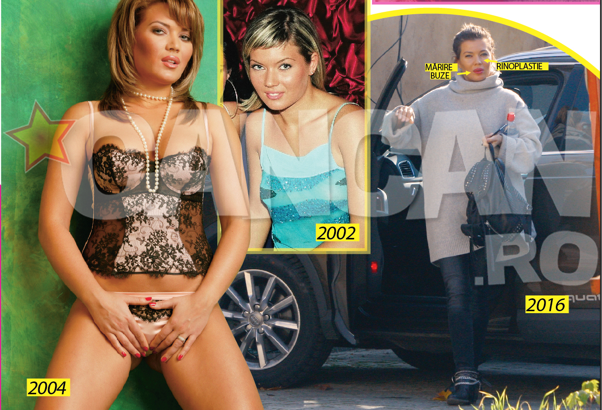 Din dorinta de a atinge perfectiunea vedeta a apelat la operatii estetice