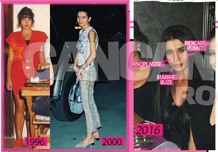 Pentru a arata mai bine, Eba a ales să apeleze la unele operatii estetice