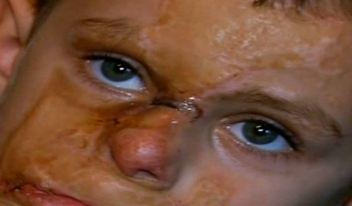 Paulică a rămas mutilat pe viaţă 